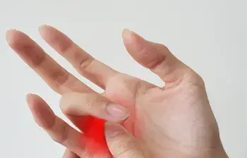 trigger finger
