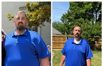 George's Patient Story