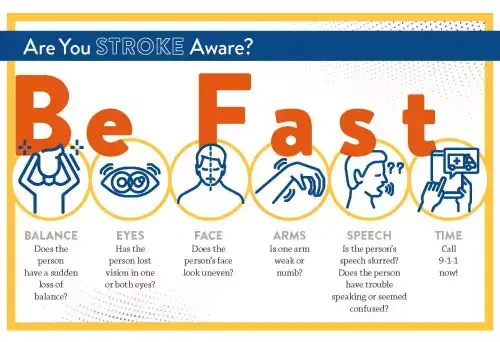 Know the signs of a stroke.