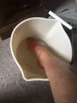 Content image: Sue soaking her foot and ankle in ice. Image file: Sue soaking her foot and ankle in ice.