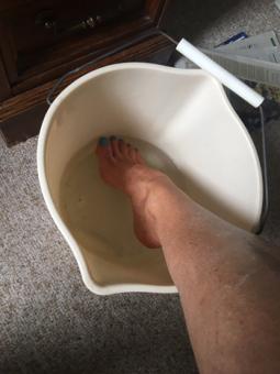 Content image: Sue soaking her foot and ankle in ice. Image file: Sue soaking her foot and ankle in ice.